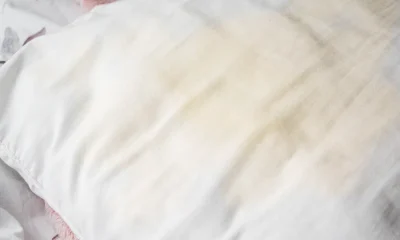 How Can I Make Yellow Pillowcases White Again?