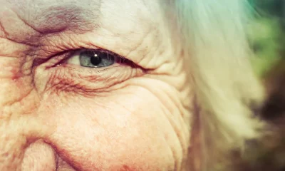 Photos Of This Body Part Could Help Predict Alzheimer's Risk