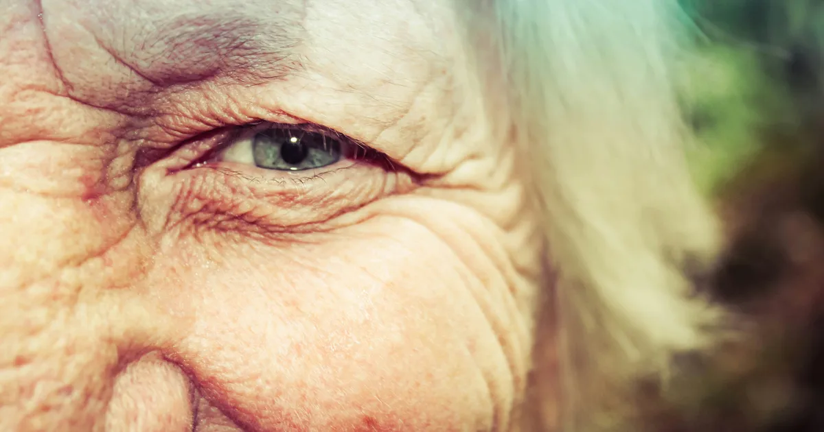 Photos Of This Body Part Could Help Predict Alzheimer's Risk
