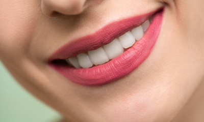 The Beauty Lover’s Guide to Veneers and Smile Makeover Myths