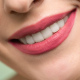 The Beauty Lover’s Guide to Veneers and Smile Makeover Myths
