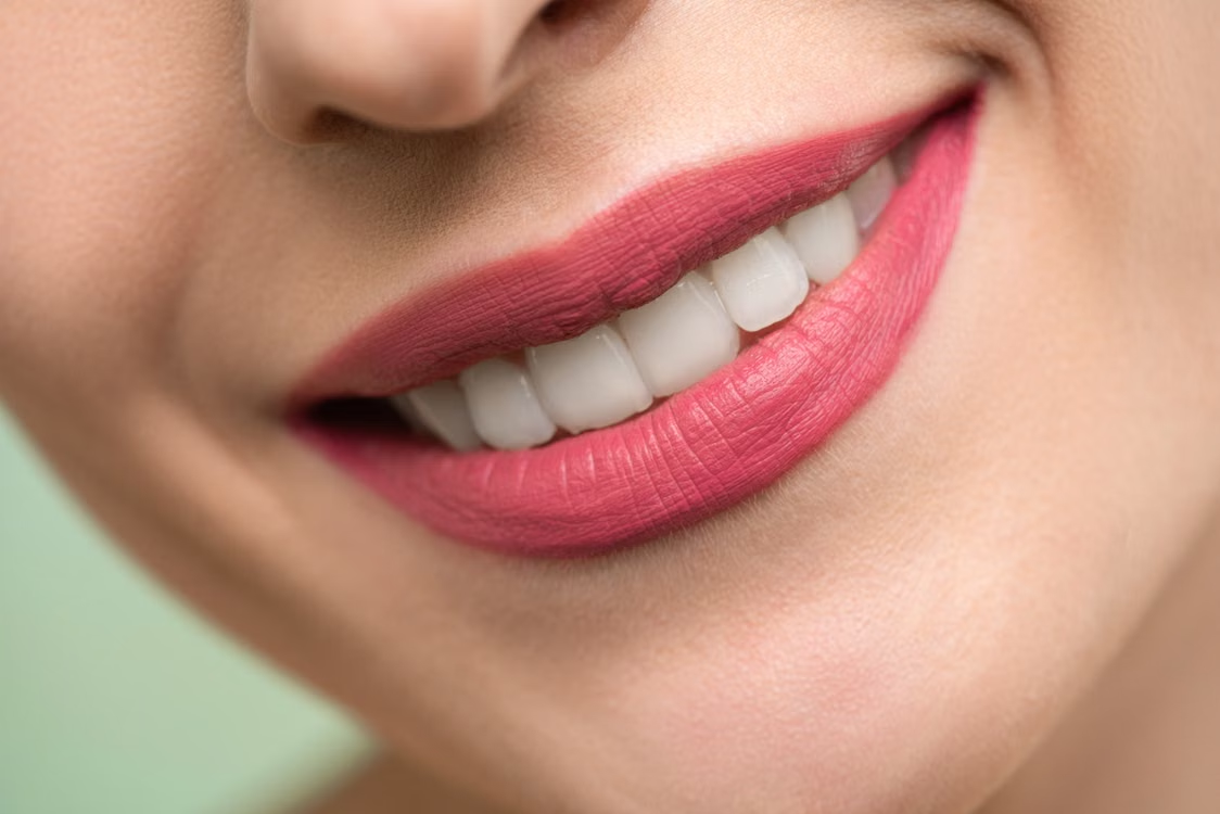 The Beauty Lover’s Guide to Veneers and Smile Makeover Myths