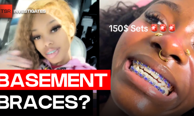 Basement Braces Are Going Viral And Dentists Are Concerned
