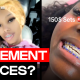 Basement Braces Are Going Viral And Dentists Are Concerned