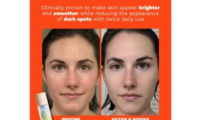 Uneven Skin Tone? This Brightening Serum Improves Discoloration