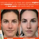 Uneven Skin Tone? This Brightening Serum Improves Discoloration