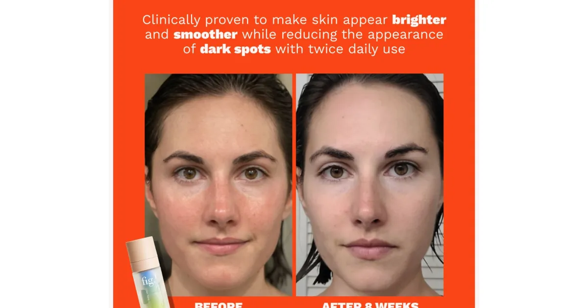 Uneven Skin Tone? This Brightening Serum Improves Discoloration