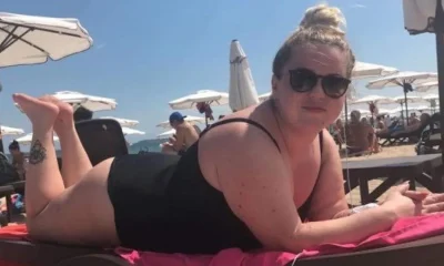 Tanning was my pre-holiday ritual - then I found a mole