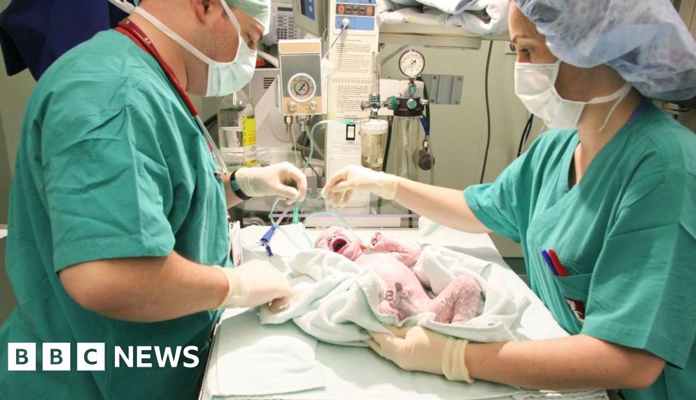 One in four births in England are now emergency caesareans, BBC analysis shows