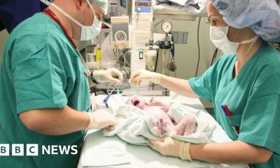 One in four births in England are now emergency caesareans, BBC analysis shows