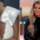 Reality star 'scarred for life' after being mauled by XL Bully