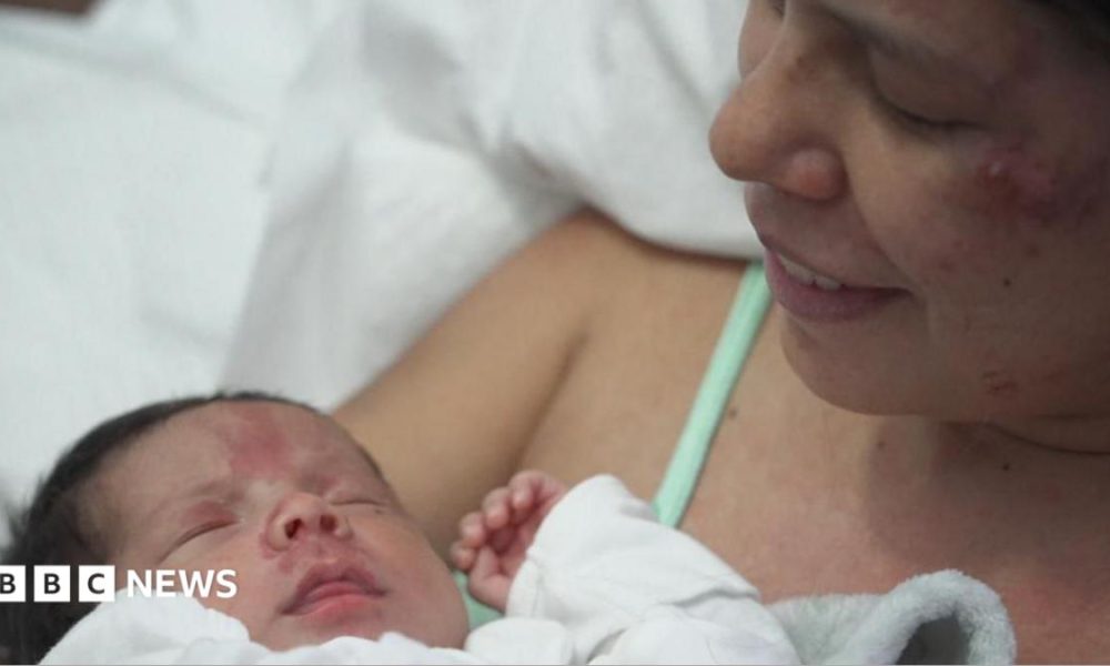 Dayana Patino grins as she holds her son Juan David close to her chest from a hospital bed. Her husband, Gerson, stands beside them wearing a light blue t-shirt.