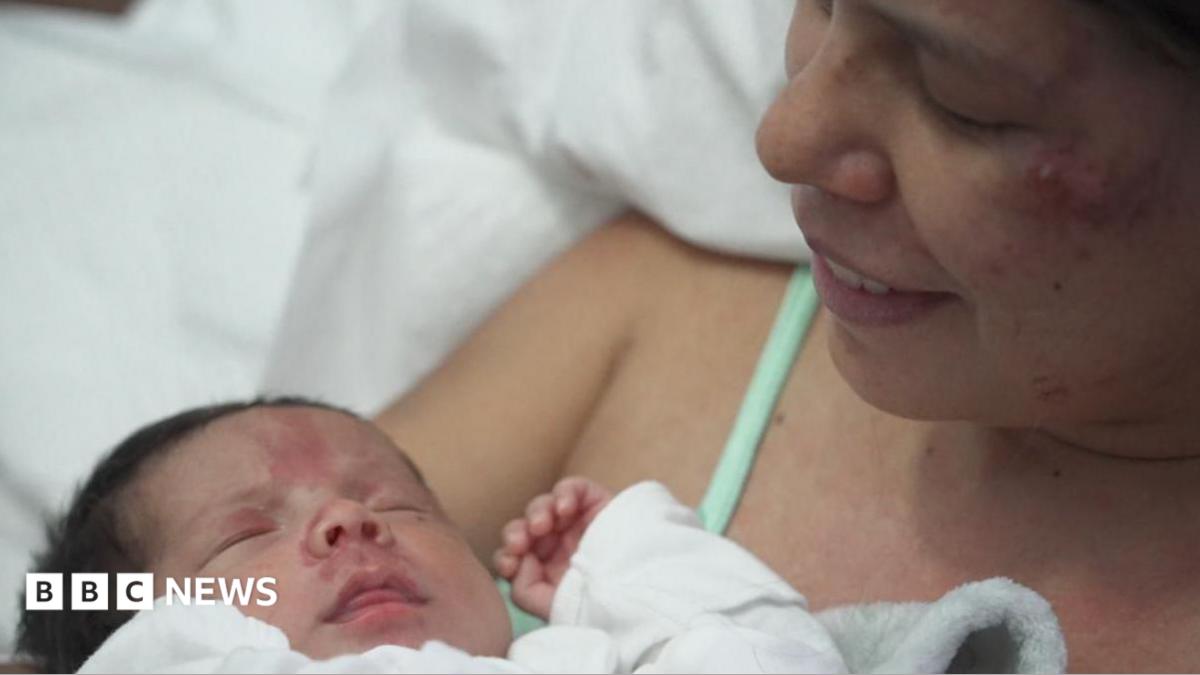 Dayana Patino grins as she holds her son Juan David close to her chest from a hospital bed. Her husband, Gerson, stands beside them wearing a light blue t-shirt.