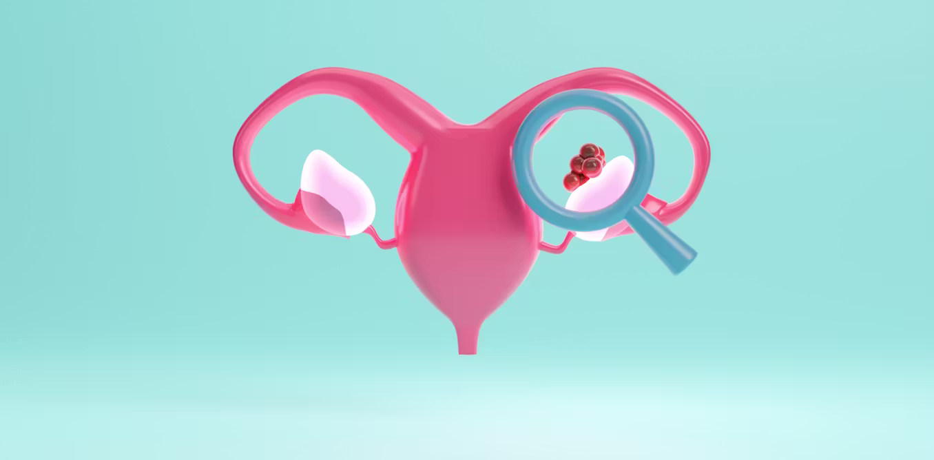 Ovarian cancer drug approved for NHS use will prolong lives