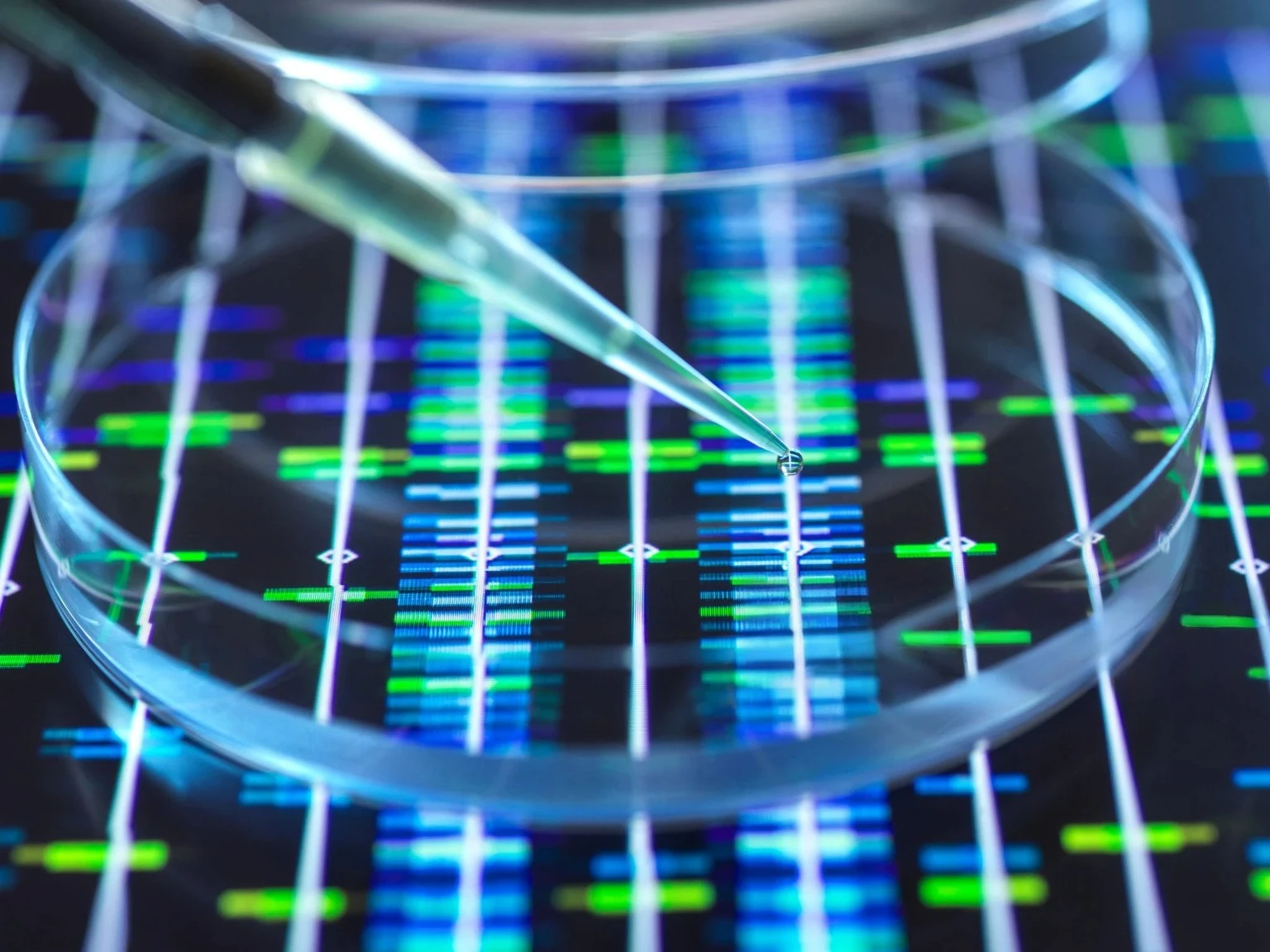 Ultragenyx: The Setrusumab Reset Creates A Cleaner Rare Disease Opportunity
