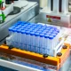 Regenxbio: 'Strong Buy' On FDA Course Reversal For NAVSUNLI And Potential AA DMD Filing