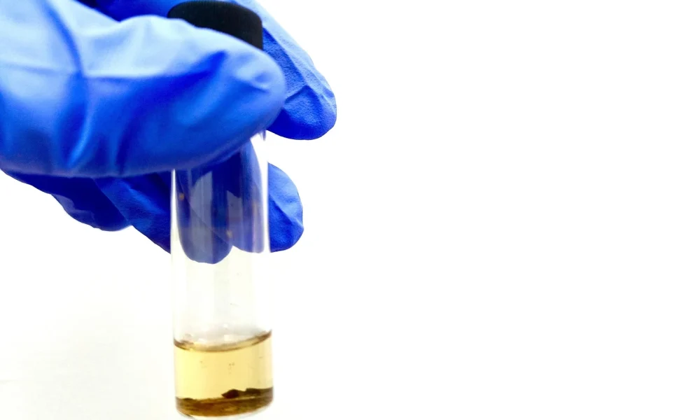 ADC Therapeutics: 'Sell' LOTIS-5 Underwhelms And Possible Change In Strategy
