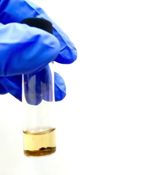 ADC Therapeutics: 'Sell' LOTIS-5 Underwhelms And Possible Change In Strategy