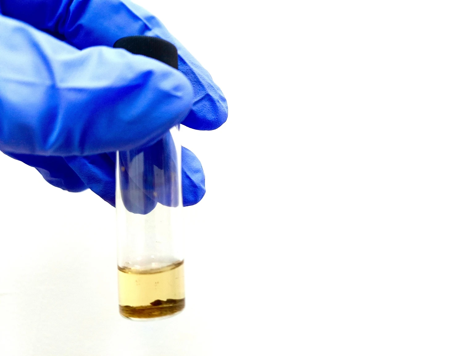 ADC Therapeutics: 'Sell' LOTIS-5 Underwhelms And Possible Change In Strategy