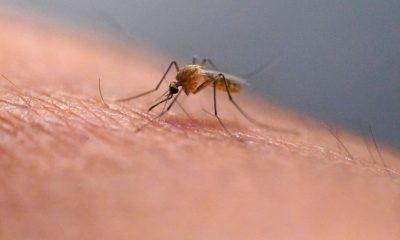 You've been told you shouldn't scratch that itch. Is that true?