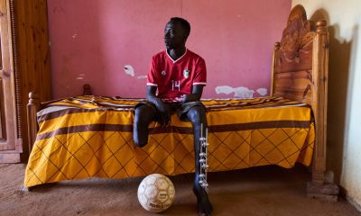 Photos of the scars of war among survivors in Sudan