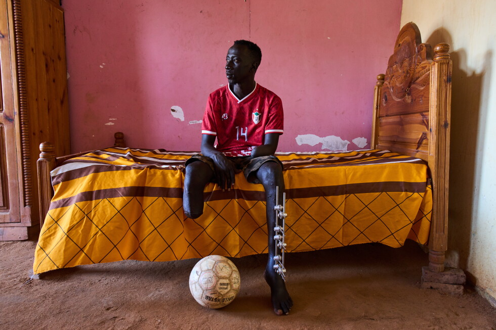 Photos of the scars of war among survivors in Sudan