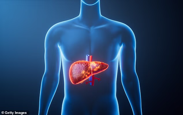 Fatty liver disease is now one of the fastest¿growing health problems globally
