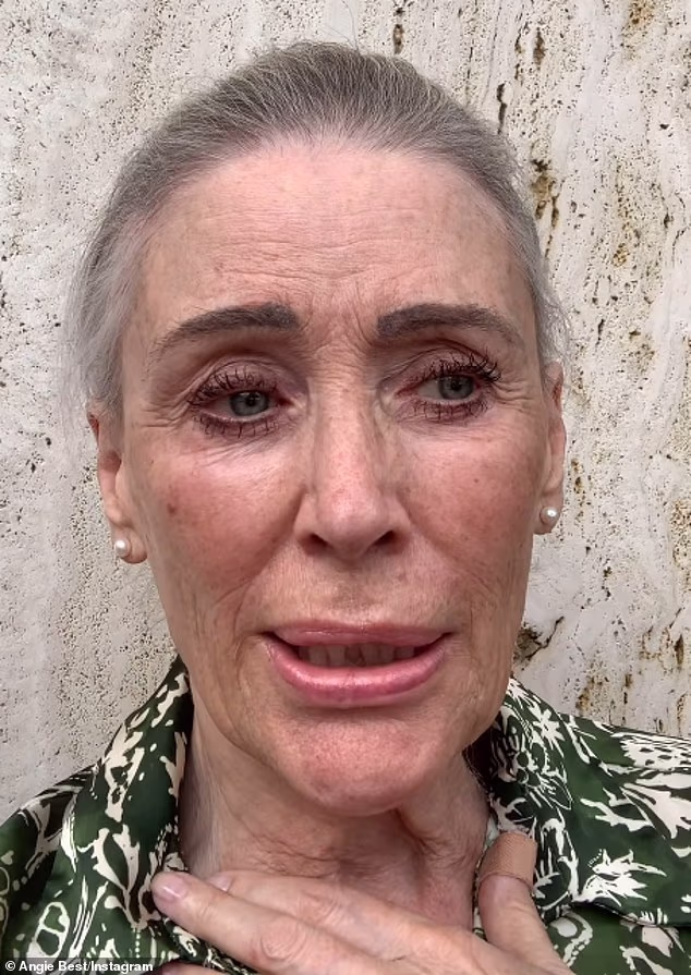 Angie Best has revealed that she has to undergo major surgery soon as she shared a new health update on Monday after being diagnosed with colon cancer