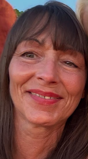 Denise noticed that her 'face was lopsided' shortly before her 30th birthday (pictured before treatment)