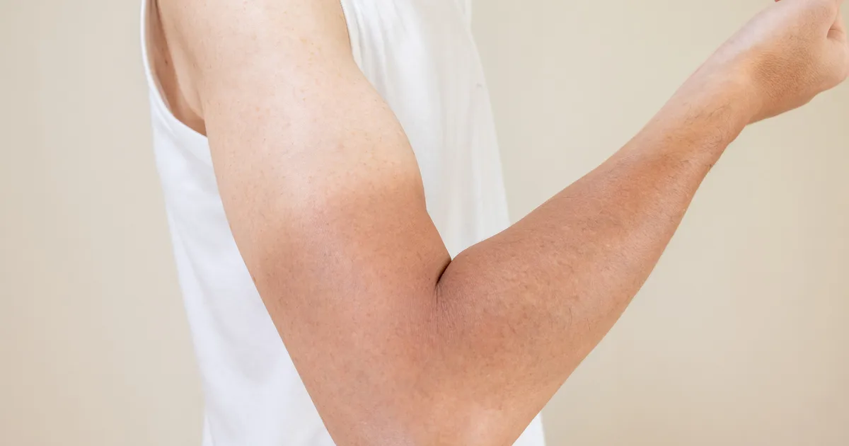 The Viral 'Tanmaxxing' Trend Is Ruining Teen Skin