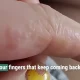 Do you ever get tiny itchy bumps on your fingers?