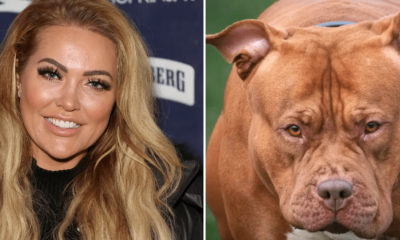 Reality star attacked by XL Bully shares details of bone-crunching injuries