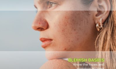 How to get ride of acne blemishes