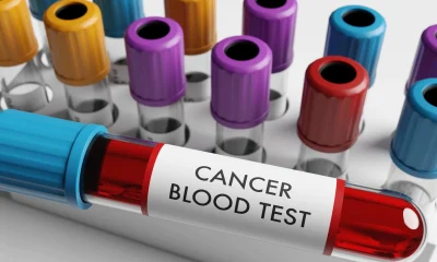Caris Life Sciences: Disrupting Cancer Screening And Therapy Selection (NASDAQ:CAI)