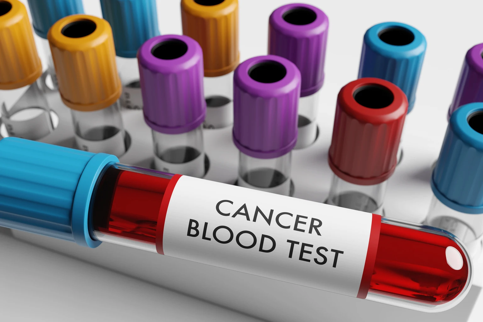Caris Life Sciences: Disrupting Cancer Screening And Therapy Selection (NASDAQ:CAI)