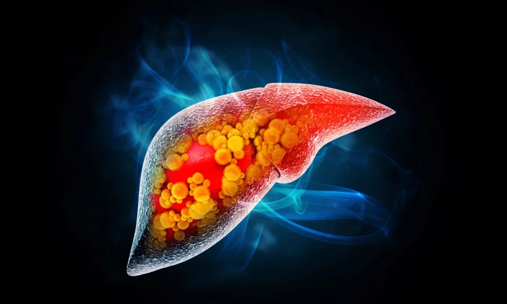 Mirum Pharmaceuticals: This Liver Disease Juggernaut Just Broadened Its Portfolio