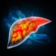Mirum Pharmaceuticals: This Liver Disease Juggernaut Just Broadened Its Portfolio