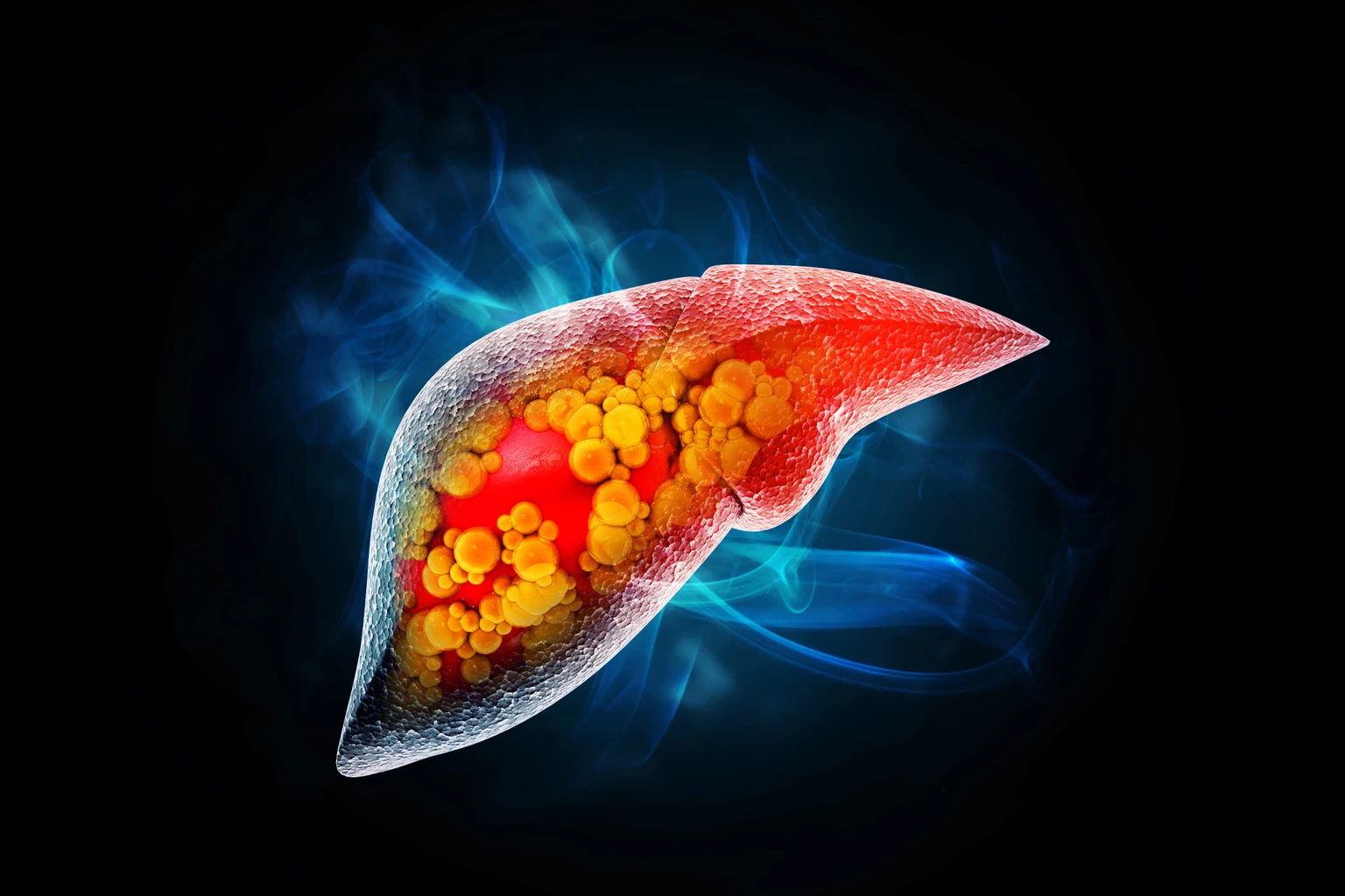 Mirum Pharmaceuticals: This Liver Disease Juggernaut Just Broadened Its Portfolio