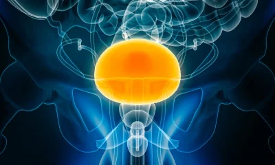 CG Oncology Stock: Priced To Perfection On Future Pipeline Success (NASDAQ:CGON)