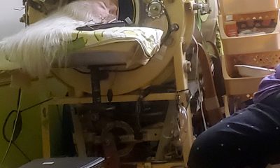 Martha Lillard, last US polio patient using iron lung, dies at 78