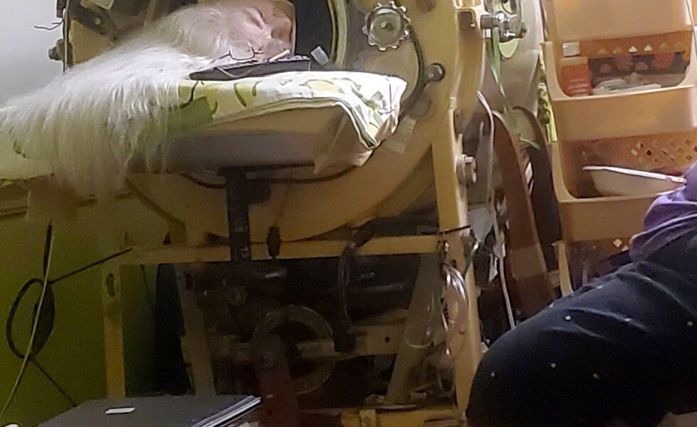 Martha Lillard, last US polio patient using iron lung, dies at 78