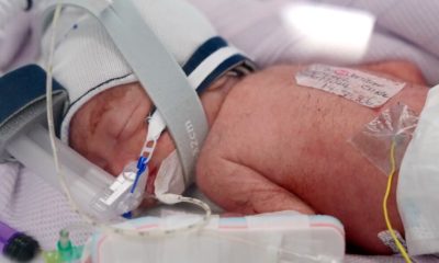 Australian woman gives birth to identical quadruplet girls