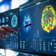 AI is speeding up cancer detection and drug discovery, doctor says