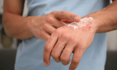 When to See a Specialist for a Slow-Healing Wound