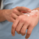 When to See a Specialist for a Slow-Healing Wound