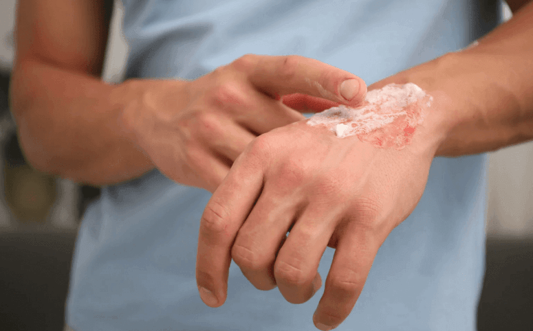 When to See a Specialist for a Slow-Healing Wound