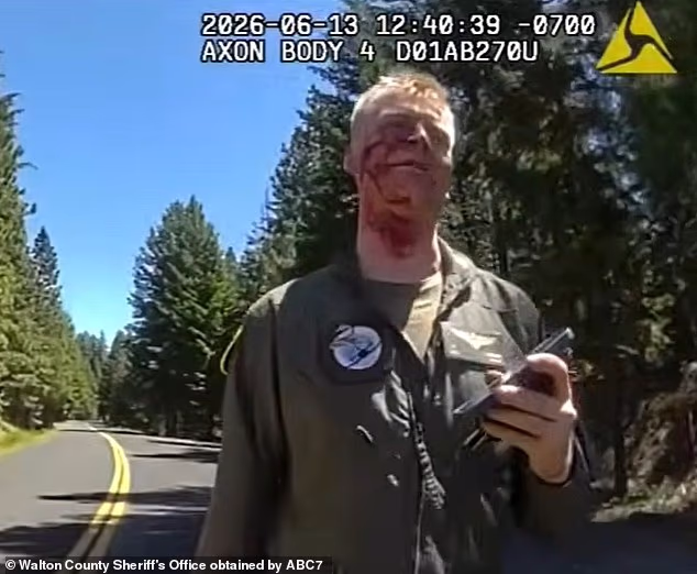 Shocking new video shows the bloodied, shaken pilot approaching officers after he ejected from his aircraft
