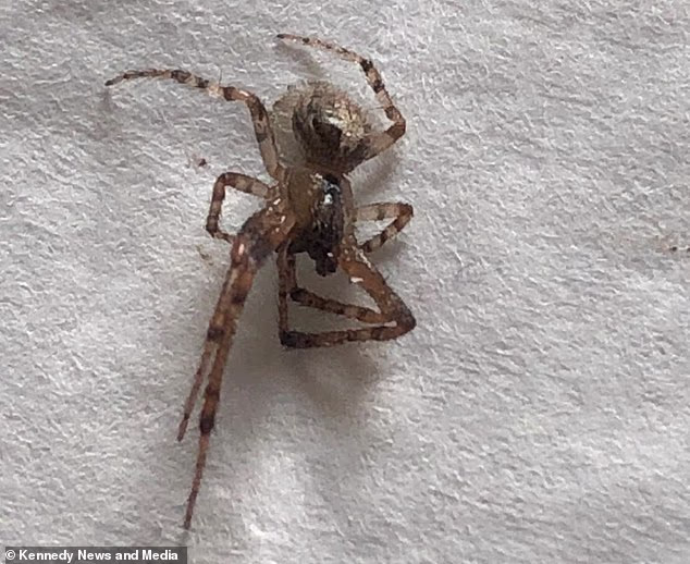 A woman in Kent was left with a 'crater' in her leg after multiple bites from a false widow spider