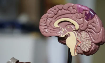 Dementia May Look Different For Women Than Men