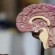 Dementia May Look Different For Women Than Men